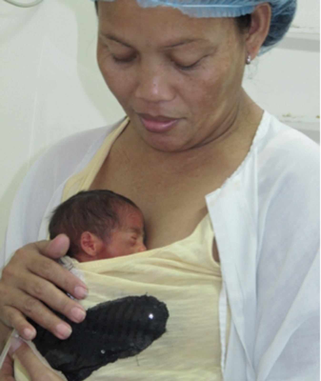 KMC Program at Gat Andres Bonifacio Memorial Medical Center In Partnership with PAP and Manila LGU